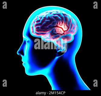 Ein Teil des Gehirns im Profil, Teile des Gehirns. Degenerative Erkrankungen, Parkinson, Synapsen, Neuronen, Alzheimers. Menschliche Anatomie, Hirnscan Stockfoto