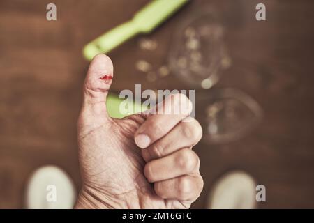 Nahaufnahme eines geschnittenen weiblichen Fingers auf dem Hintergrund einer geteilten Tasse und einer Bürste mit einer Kehrschaufel zum Reinigen. Eine Wunde mit Blut, die beim Reinigen von zerbrochenem Geschirr erhalten wurde. Hochwertige Fotos Stockfoto