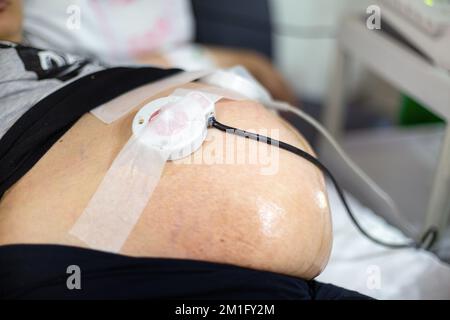 Schwangeren-Herzfrequenzkartenprüfung beim pränatalen Baby Stockfoto
