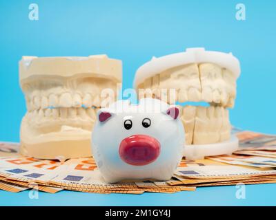 Zahngips, Sparschwein und Banknoten auf blauem Hintergrund. Gipsmodell der Zähne. Nahaufnahme. Stockfoto