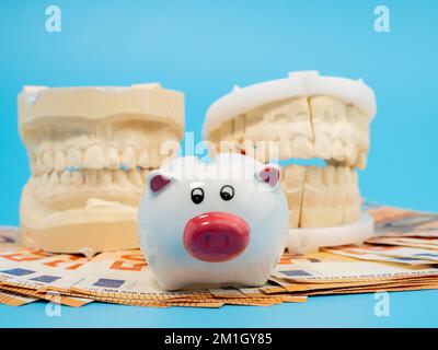 Zahngips, Sparschwein und Banknoten auf blauem Hintergrund. Gipsmodell der Zähne. Nahaufnahme. Stockfoto