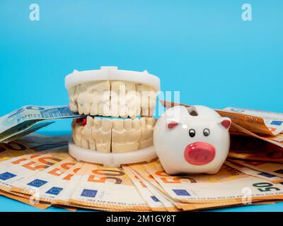 Zahngips, Sparschwein und Banknoten auf blauem Hintergrund. Gipsmodell der Zähne. Nahaufnahme. Stockfoto