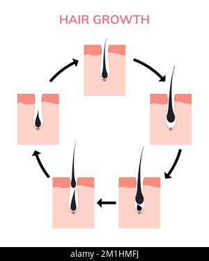 Haarwuchszyklus Haut. Follikel Anatomie Anagen Phase, Haarwachstum Diagramm Illustration Stock Vektor
