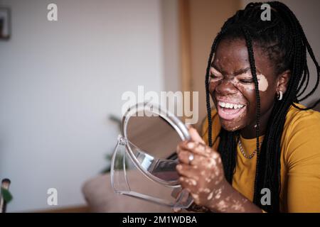 Fröhliche afroamerikanische Frau mit Vitiligo-Spiegel Stockfoto