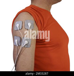 Eine Person mit Elektroden am Arm ist eine effektive Methode zur Rehabilitation, Massage oder Stimulation der Muskeln Stockfoto