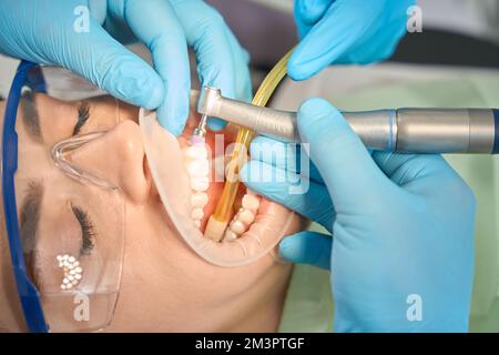 Arzt, der Zahnpolierverfahren am Patienten mit Hilfe einer Krankenschwester durchführt Stockfoto