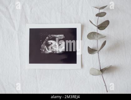 Draufsicht Röntgenfoto Fetus. Auflösung und hochwertige Fotos Stockfoto
