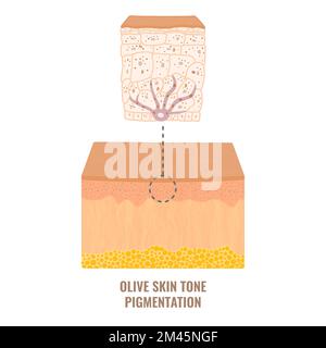 Olive Hautton Pigmentierung Mechanismus medizinische Diagramm Stock Vektor