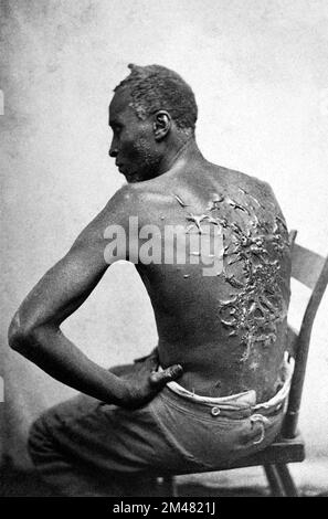 Hat Peter oder Gordon geschlagen, einen entflohenen Sklaven, der oft geschlagen wurde. Foto: Matthew Brady, 1863. Stockfoto