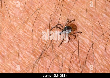 Europäische Rizinuspflanze Tick, europäischen Schafe Zecke (Ixodes Ricinus), Weiblich auf der menschlichen Haut, Deutschland Stockfoto