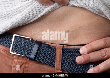 Makro eines Maulwurfs an der Leiste eines Weißen. Von Hand angehobene Gürtel- und Pullover-Details. Zum Begriff Melanom oder Melasma durch Sonnenstrahlung Stockfoto