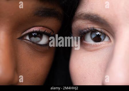 Heterochromie bei hellen und dunklen Augen. Kaukasischer und afrikanischer Teint mit chimären Phänomenen in Augen mit Teilen verschiedener Farben Stockfoto