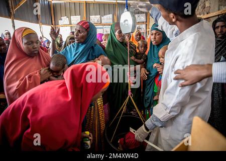 Mogadischu, Somalia. 19. Dezember 2022. Ein Kind wird in einer Gesundheitsklinik in Baidoa auf Unterernährung untersucht. Das Horn von Afrika leidet unter seiner schlimmsten Dürre seit Jahrzehnten, wobei Millionen Somalier Nahrungsmittel, Hilfe und humanitäre Hilfe benötigen. (Kreditbild: © Sally Hayden/SOPA Bilder über ZUMA Press Wire) Stockfoto