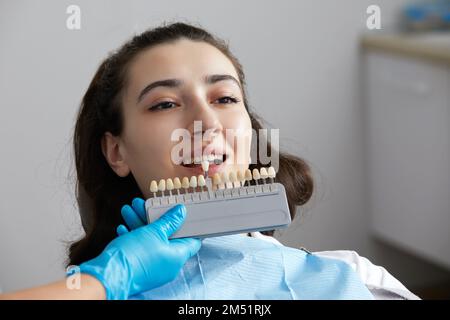 Zahnarzt wählt den Farbton des Zahnschmelzes für den Patienten. Zahnarztprobe aus der Zahnschmelzskala Stockfoto