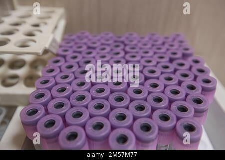 Blutprobenröhrchen aus einem Regal mit Analysegeräten im Laborhintergrund. In Blutbanken von Laborzentrifugenmaschinen vorbereitete Röhrchen. Stockfoto
