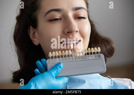 Zahnarzt wählt Zahnschmelzfarbe für den Patienten. Zahnarzt bei der Applikation von Zahnschmelzproben auf Weibenzähne Stockfoto