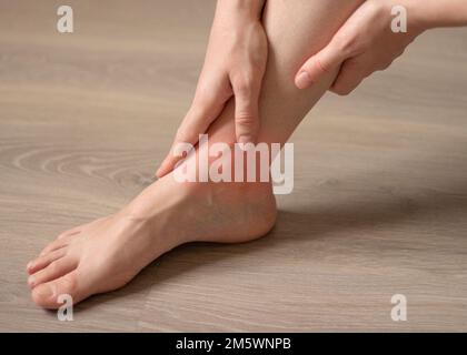 Schmerzen in den Beinen. Frauenfüße auf dem Boden. Orthopädische Erkrankungen Gelenke, Muskeln. Gesundheitsproblem Stockfoto