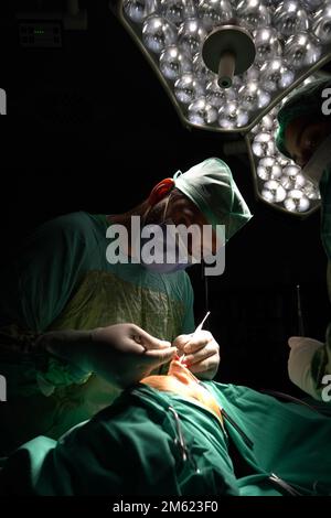 Rhinoplastik-Chirurgie, Defekte der Nasenform bei der Patientin. Chirurgische Eingriffe bei plastisch-chirurgischen Rhinoplastiken Stockfoto