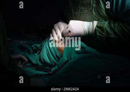 Rhinoplastik-Chirurgie, Defekte der Nasenform bei der Patientin. Chirurgische Eingriffe bei plastisch-chirurgischen Rhinoplastiken Stockfoto