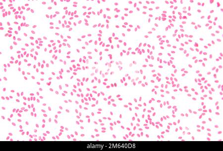 Fischblut, Abstrich, 80X-Lichtmikroskopie. Fischblut-Erythrozyten mit Mikronukleus, unter dem Lichtmikroskop. Stockfoto