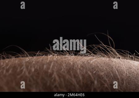 Menschliche Haut mit Haaren auf schwarzem Hintergrund. Gänsehaut. Stockfoto