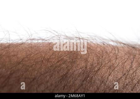 Menschliche Haut mit Haaren auf weißem Hintergrund. Gänsehaut. Stockfoto