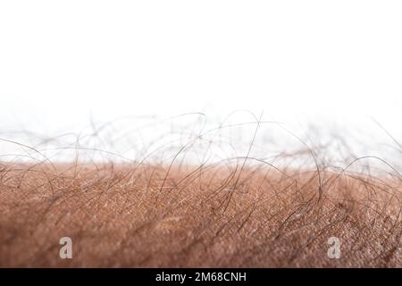 Menschliche Haut mit Haaren auf weißem Hintergrund. Gänsehaut. Stockfoto