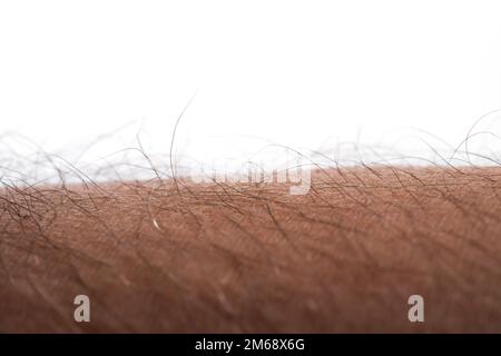 Menschliche Haut mit Haaren auf weißem Hintergrund. Gänsehaut. Stockfoto