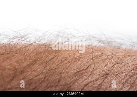 Menschliche Haut mit Haaren auf weißem Hintergrund. Gänsehaut. Stockfoto