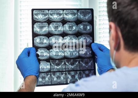 Arzt aufmerksam untersucht die MRT der Patienten scannen Stockfoto