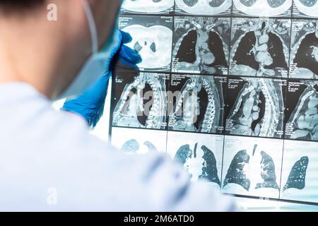 Arzt aufmerksam untersucht die MRT der Patienten scannen Stockfoto