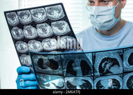 Der Arzt in der Maske untersucht und vergleicht zwei MRT-Aufnahmen. Stockfoto