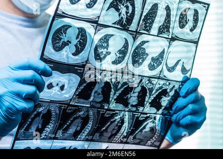 Arzt aufmerksam untersucht die MRT der Patienten scannen Stockfoto