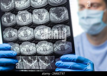 Arzt aufmerksam untersucht die MRT der Patienten scannen Stockfoto