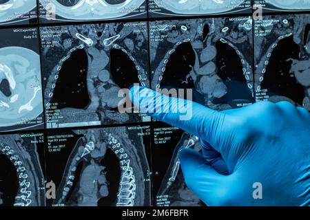 Arzt aufmerksam untersucht die MRT der Patienten scannen Stockfoto