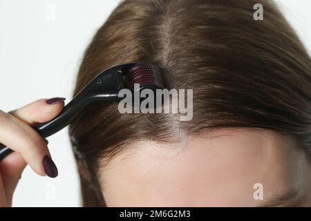 Frau mit Mikroneedle-Dermawalze am Kopf zur Stimulierung des neuen Haarwuchses. Einfache und günstige Behandlung für die gesunde Kopfhaut. Stockfoto