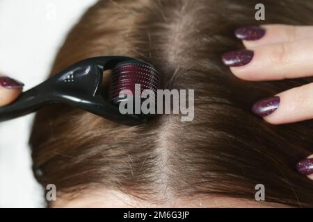 Frau mit Mikroneedle-Dermawalze am Kopf zur Stimulierung des neuen Haarwuchses. Einfache und günstige Behandlung für die gesunde Kopfhaut. Stockfoto