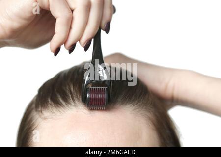 Frau mit Mikroneedle-Dermawalze am Kopf zur Stimulierung des neuen Haarwuchses. Einfache und günstige Behandlung für die gesunde Kopfhaut. Stockfoto