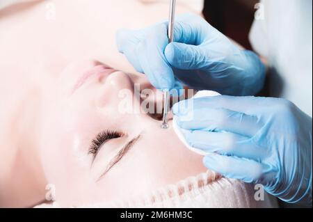 Nahaufnahme des Gesichts einer jungen Weißen und die Hände eines Kosmetikers in Handschuhen führen mechanische Reinigung und Entfernung durch Stockfoto
