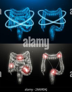 Polygonale Vektordarstellung eines entzündeten menschlichen Darmes und Wiederherstellung der Darmfunktion. Innere Organe mit geringer Poly-Desig Stockfoto