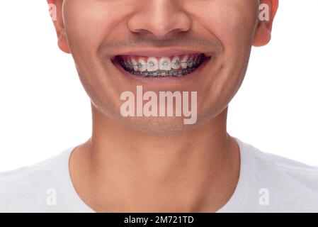 Ein lateinamerikanischer Mann lächelt, zeigt seine Edelstahlspange für seine Kieferorthopädie, ohne seine Augen mit weißem Hintergrund zu zeigen, ein Mann Stockfoto