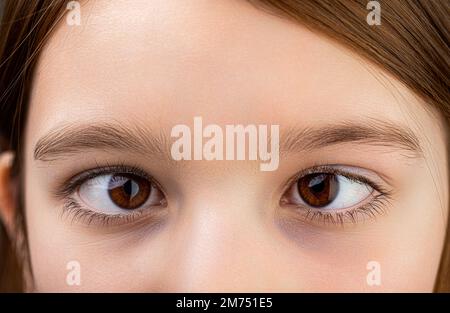 Schielen. Nahaufnahme Teil Kindergesicht, Eyes Girl. Little Patient Strabismus, Behandlung ophthalmischer Erkrankungen. Schielen bei Kindern Ursachen, Behandlung Stockfoto