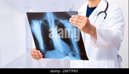 Lungenkrebs oder Pneumonie. Arzt-Check-up Röntgenbild haben Problem Lungentumor des Patienten oder lange covid 19 Stockfoto