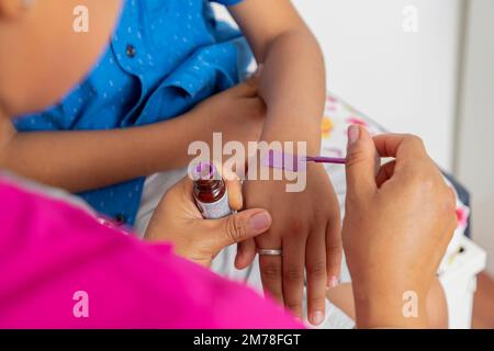 Unerkennbare Ärztin, Verband an einem Kind, das seinen Arm verletzt hat, Nahaufnahme von Händen, die ein Heilmittel machen. Stockfoto