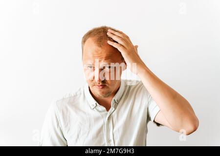 Vor der Haartransplantation. Junger, trauriger Glatzkopf mit Depressionen bei Haarausfall, wütend und frustriert aussehend und seinen Kopf zu halten Stockfoto