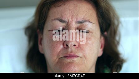 Ältere Frau mit Bluterguss, Narbengesicht, die die Augen öffnet und in die Kamera schaut Stockfoto