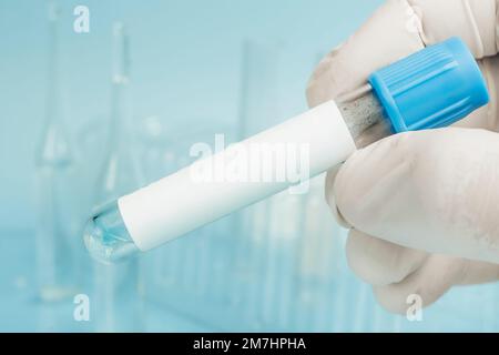 Bluttest. Reagenzgläser auf blauem Hintergrund. Durchsichtige Flüssigkeit in einem Glasrohr in der Hand einer Laboratoriumsgehilfin. DNA-Test. Labortests Stockfoto