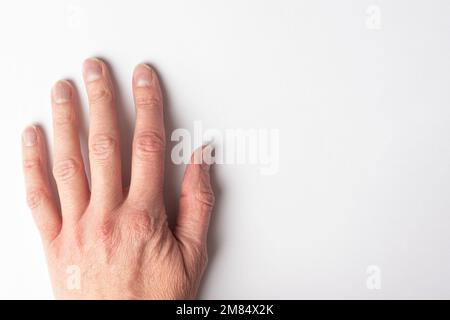 Nahaufnahme einer uralten Frauenhand mit Falten mit natürlichen Nägeln, überwucherter Kutikula auf weißem Hintergrund, Draufsicht, Kopierbereich. Eine Hand mit Age-RE Stockfoto