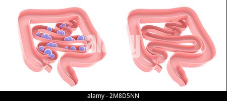 Anatomische 3D-Darstellung des Verdauungssystems mit Gasen im Dickdarm und Dünndarm. Draufsicht auf dem Boden, natürliche Farben. Stockfoto