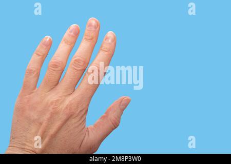 Nahaufnahme einer uralten Frauenhand mit Falten mit natürlichen Nägeln, überwucherter Kutikula auf blauem Hintergrund, Draufsicht, Kopierbereich. Eine Hand mit altersabhängiger Stockfoto